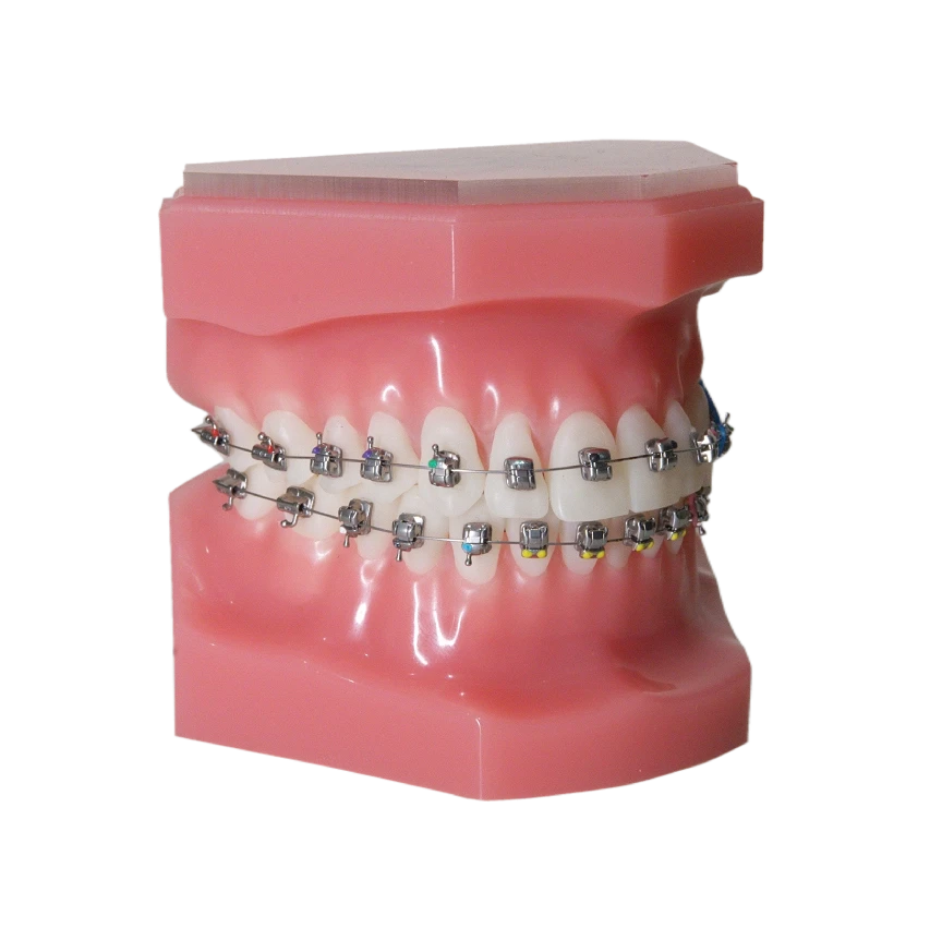 teeth-straightening