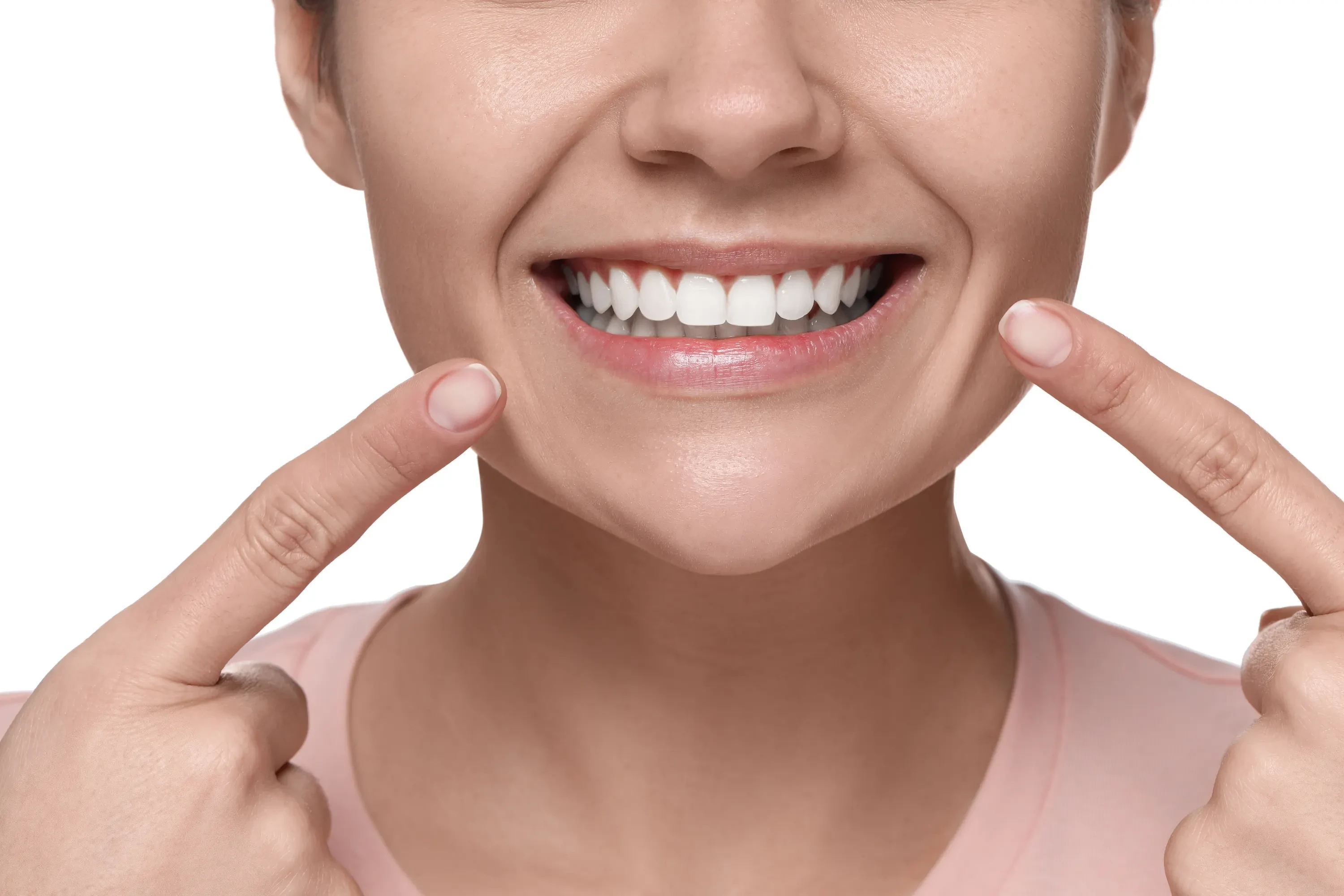 smile-makeover