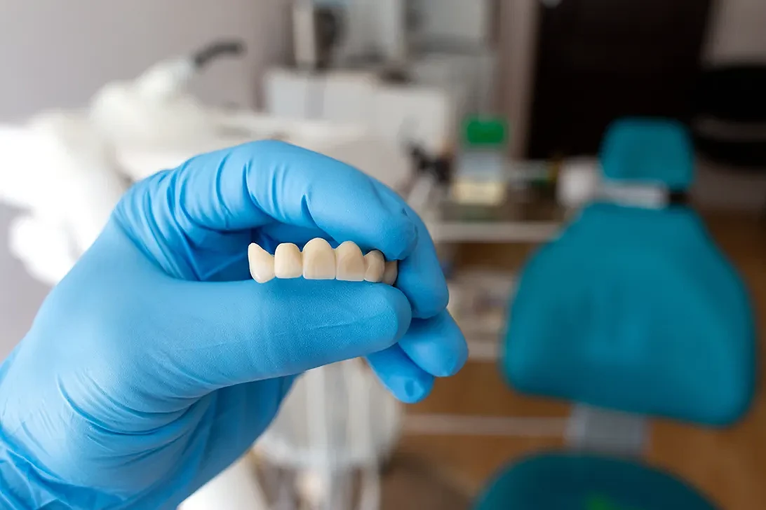 dental-bridge-in-dubai