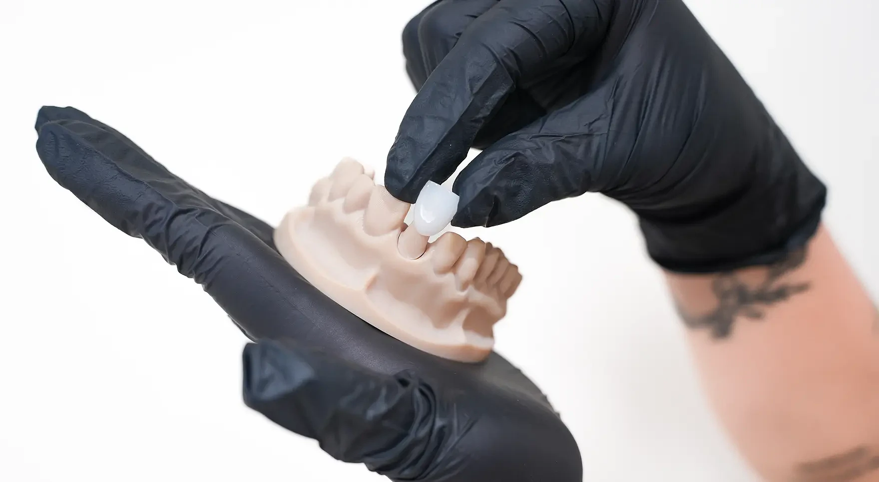 Dental Crowns main