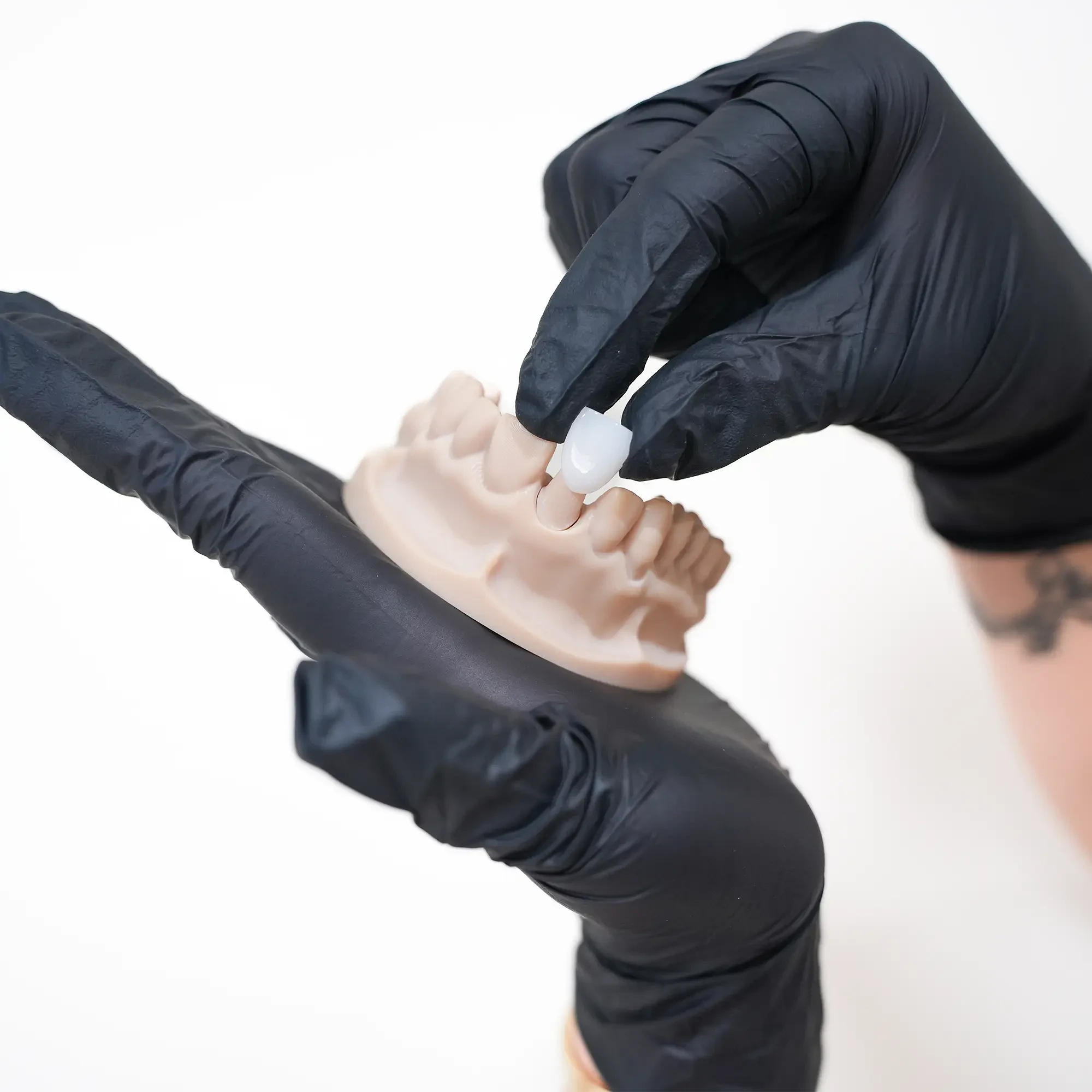 A dental crown and a three-dimensional model of the lower jaw — a visual demonstration of how a dental crown is fitted to restore the shape and strength of a tooth