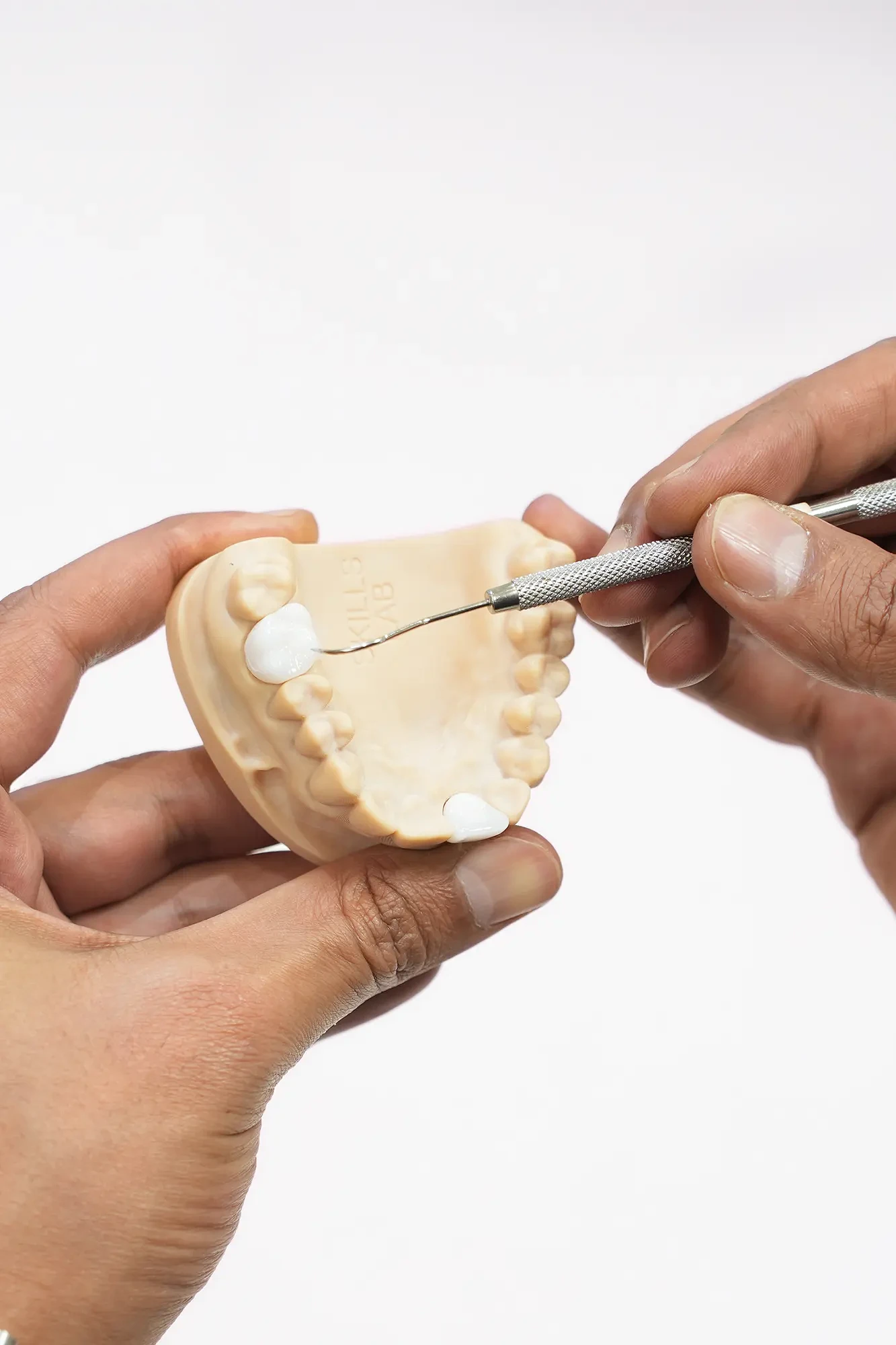dental-fillings1