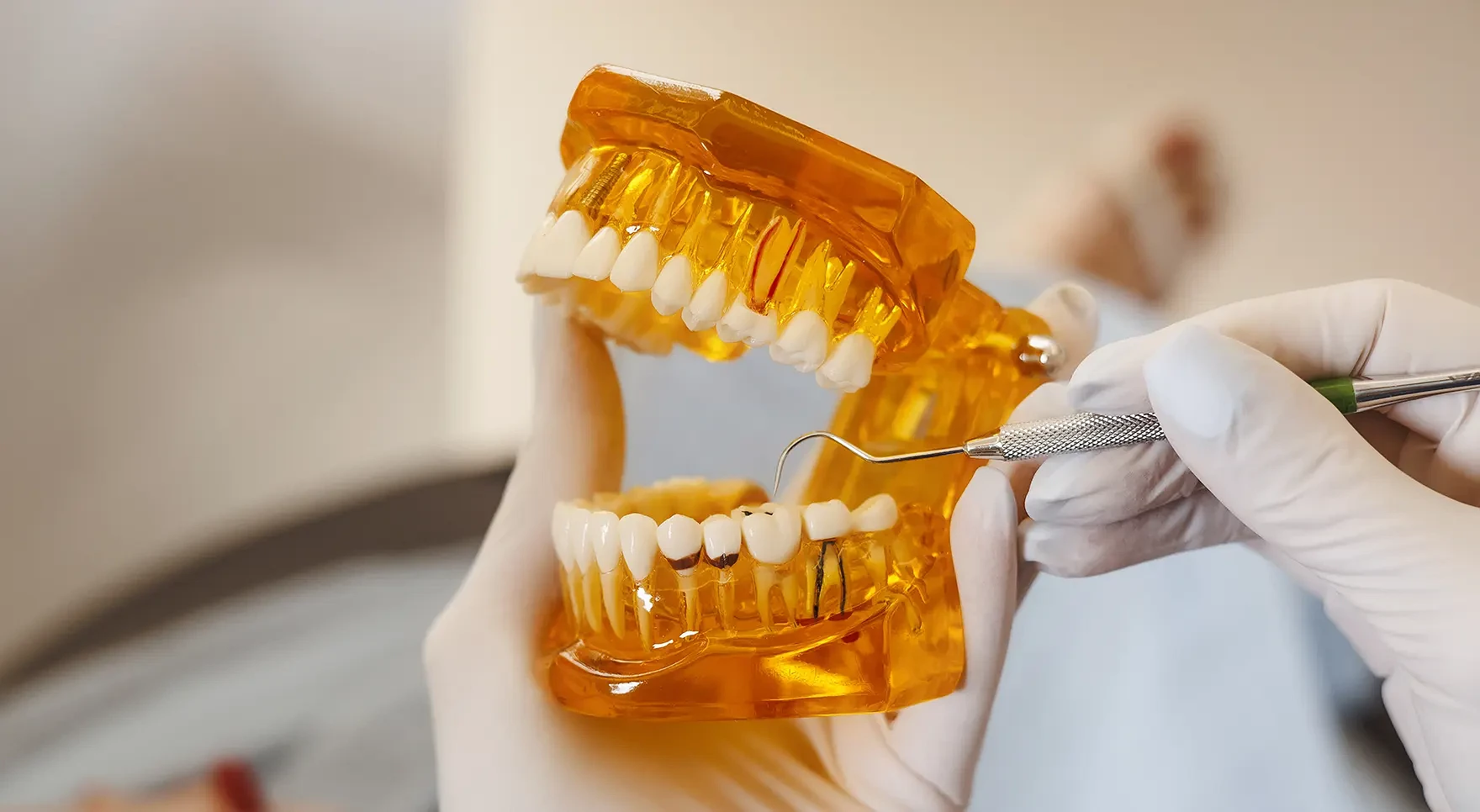 dental-fillings_main